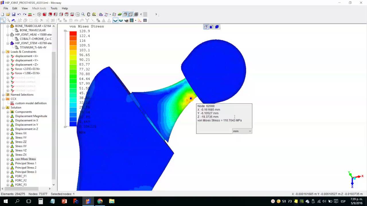 Análisis por elementos finitos implante de cadera - YouTube