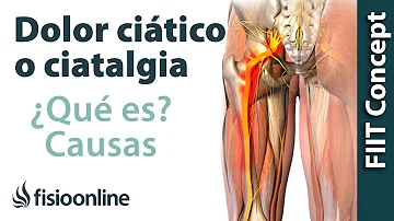 ¿Dónde duele la ciática?