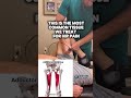 Fixing #hippain permanently #hippainrelief #hipstretch #hipexercise