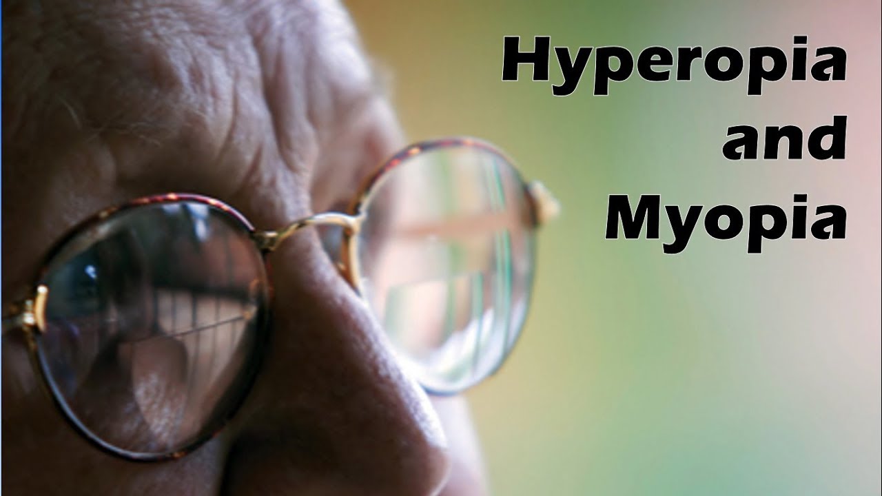 Hyperopia and Myopia - YouTube