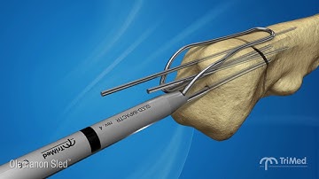 Olecranon Sled Surgical Animation