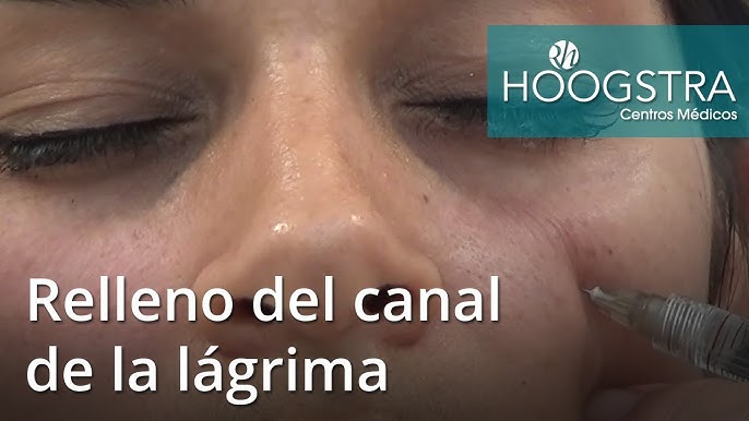 Cómo cerrar las dilataciones de la oreja con estos sencillos pasos