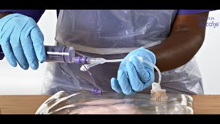 How to replace a Flocare Balloon gastrostomy tube