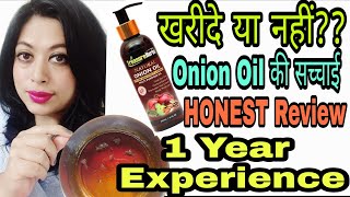 I tried ONION OIL and This Happened | Does ONION OIL works ?? HONEST REVIEW TREASURE HERBS ONION OIL