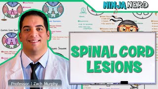 Spinal Cord Lesions: Anterior Cord, Posterior Cord, Central Cord, BrownSequard