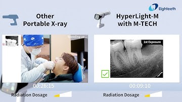 Other Portable X-ray vs. HyperLight-M with M-TECH