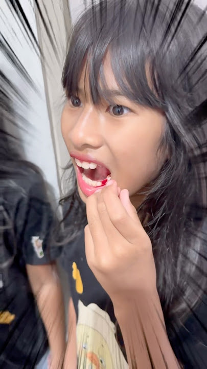 EMERGENCY!! KDISTA'S TEETH SUDDENLY FALLS OUT ON ITS OWN UNTIL IT BLEEDS😱😱 #viralvideo #viralshort