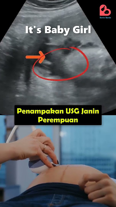Begini Penampakan Janin Perempuan saat Ibu Hamil USG