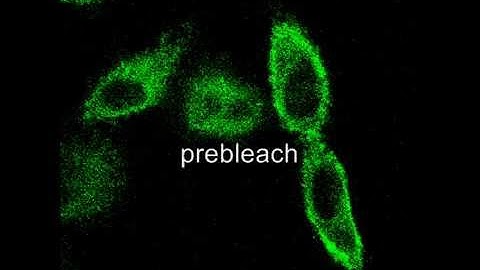 TSH receptor movement studied by fluorescence recovery after photo bleaching (FRAP)