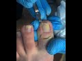 Gentle Pedicure Care | Clean Toenail Trim #fypシ #RelaxingCare #cleannails #nailcare #pedicure