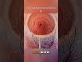 Breast Cancer Biopsy: Step-by-Step Guide #LearnOnTikTok