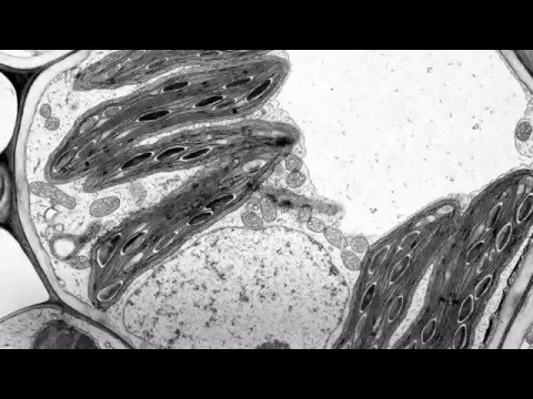 ভিডিও: ধোয়ার মহিলার মেয়ে কীভাবে মন্টমার্ট্রে শিল্পীদের প্রিয় মডেল হয়ে উঠল: সুজান ভালাদোন