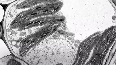 1.2 Skill: Interpretation of electron micrographs