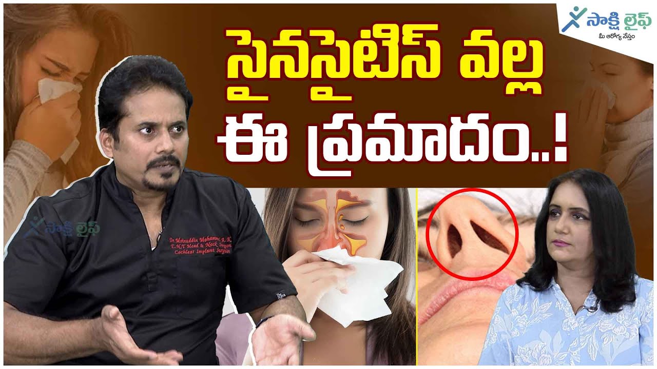 D R Mynuddin Sinusitis infection : Chronic sinusitis, Acute sinusitis | Dr ...