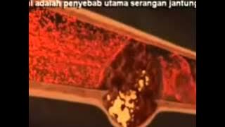 Penawar Sakit Jantung, Darah Tinggi dan Kencing Manis