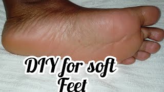 DIY foot peel at home using aspirin/ causes of cracked heels, how to prevent it