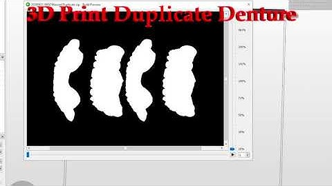 3D Print Duplicate Dentures with Asiga