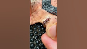 leeches bite  🤢🤮 #leech #wildlife #shorts