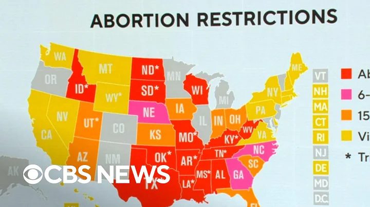 Where abortion access stands post-Dobbs decision