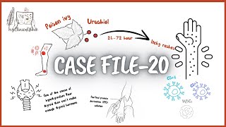 Clinical Case File-20 - Its