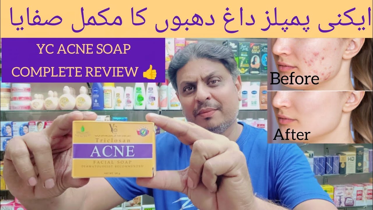 YC Acne facial soap || Dermatologist recommended