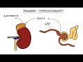 Hyperaldosteronism and Conn's Syndrome