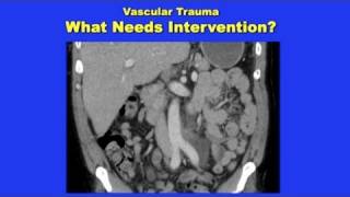 Vascular Trauma