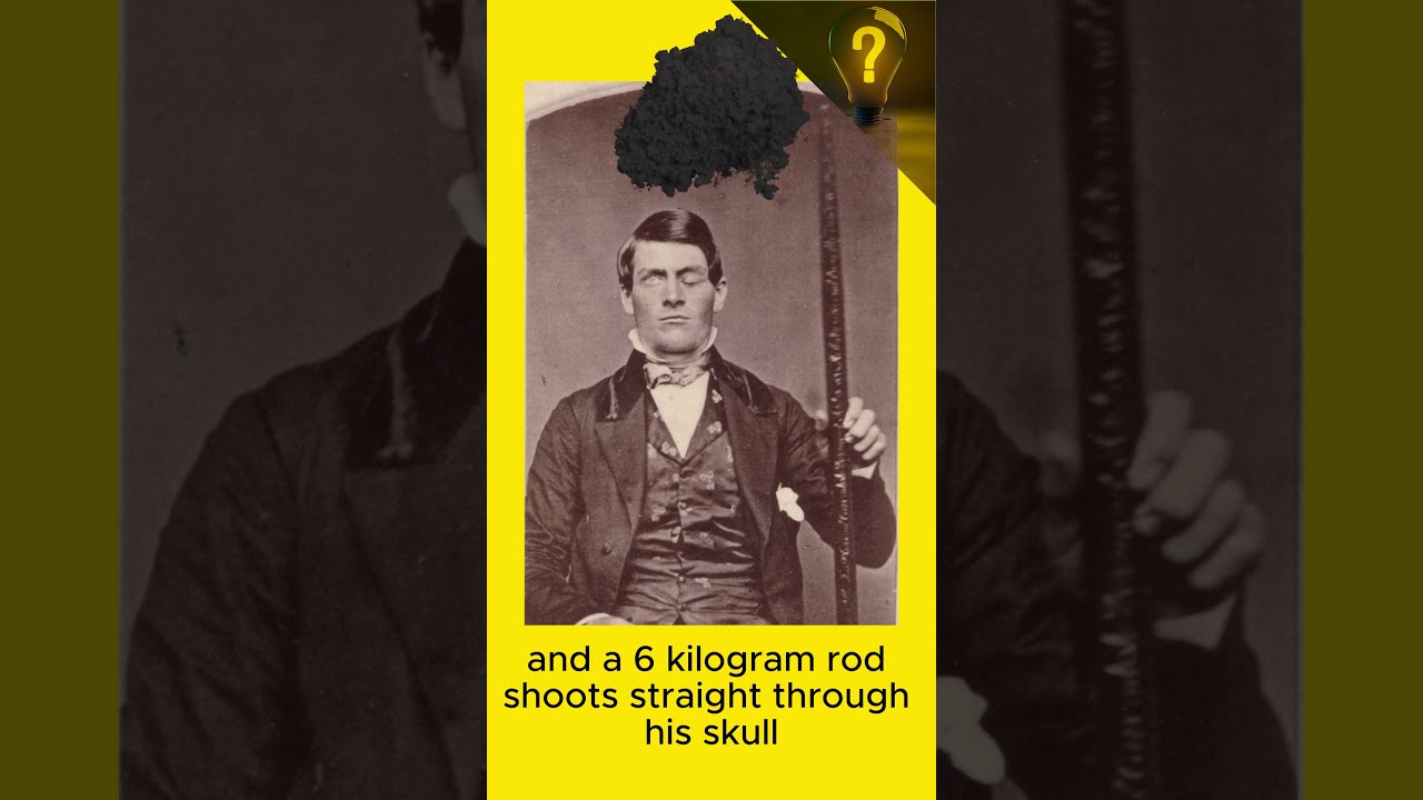 The Man Who Survived A Metal Rod Through His Brain Interestingfacts Interestingshorts