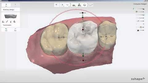 TRIOS® Practice Lab Using Anatomy Design
