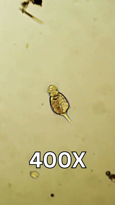 Microbes in our nails under microscope | Dust and Germs in nails - 400x Microscopic View