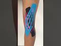 KinesioTaping for Knee Pain #kinesiotape #physiotherapist #painrehab