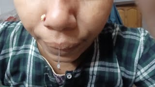 Nose Blowing Challenge👃🤧Most Requested Video 🔥🙏