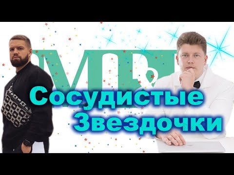 СОСУДИСТЫЕ ЗВЕЗДОЧКИ! МАЗИ ПОМОГАЮТ? Возникновение, лечение,профилактика!