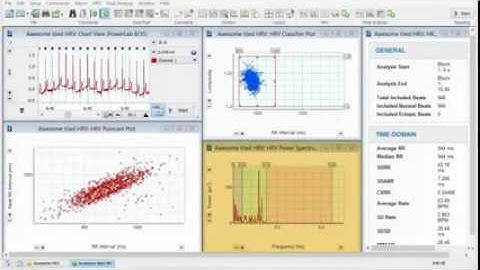 LabChart 8 新版心變異率分析模組 HRV 2.0