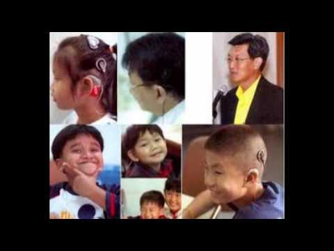 การจัดการศึกษาสำหรับผู้ที่มีความบกพร่องทางการได้ยิน