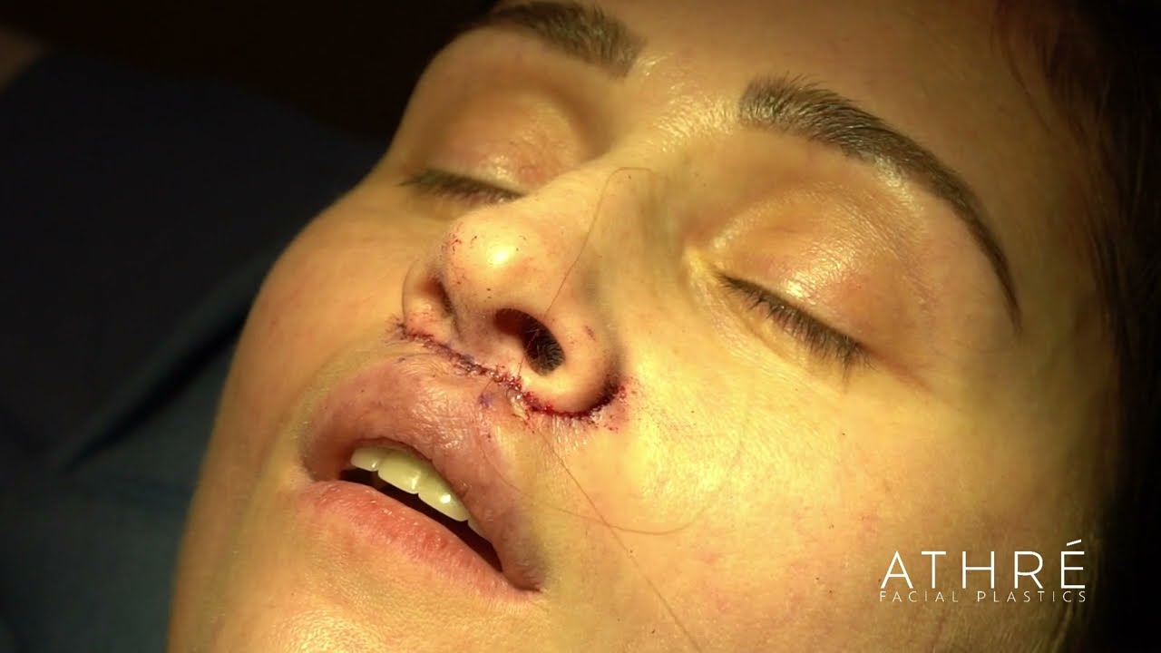 youtube-video-thumbnail