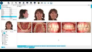 Présentation De Kitview En Version Locale