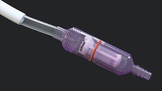 Articular Cartilage Repair Using Autologous Tissue Collected With the GraftNet™ Device screenshot 5