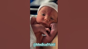 6 min 6 uur 6 dagen #schattig #medisch #pasgeboren #emotioneelmedico #pasgeboren