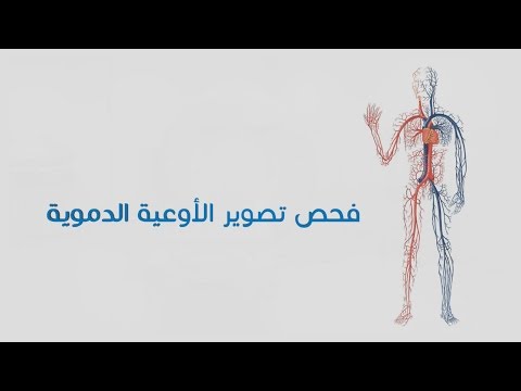 فيديو: كيفية التعافي من صورة الأوعية الدموية (بالصور)