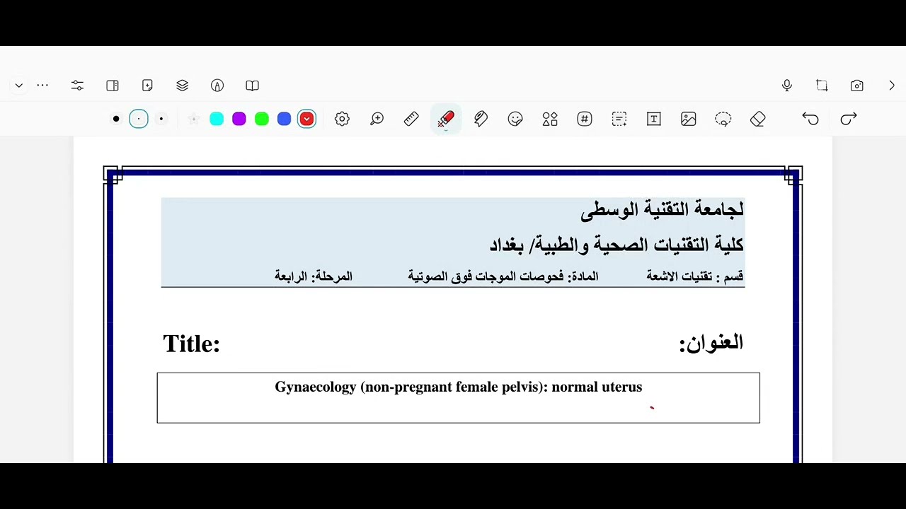 سونار وزاري 1