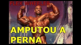 Perna fisiculturista amputado