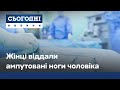 Жахлива історія на Миколаївщині: жінці віддали ампутовані ноги чоловіка