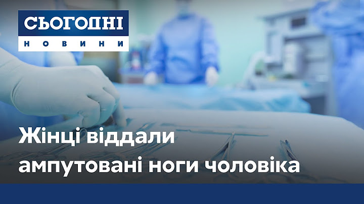 Жахлива історія на Миколаївщині: жінці віддали ампутовані ноги чоловіка