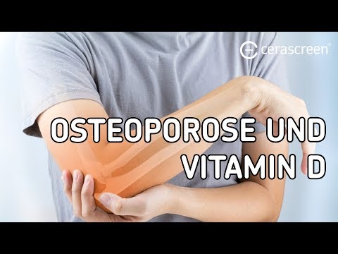 Video: Wie Wahrscheinlich Ist Es, Dass Ich Mir Einen Knochen Brechen Werde, Wenn Ich Osteoporose Habe?