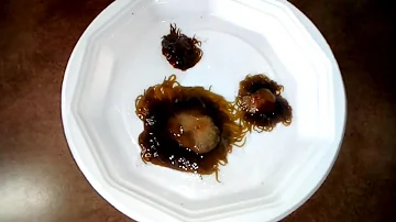 Come sono gli anemoni di mare?
