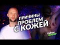 ИЗЛЕЧИ СЕБЯ! ЦЕЛИТЕЛЬ РАССКАЗАЛ О СКРЫТЫХ ПРИЧИНАХ ПРОБЛЕМ С КОЖЕЙ И ОРГАНАМИ. Антон Антонов