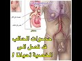 حصوات الحالب