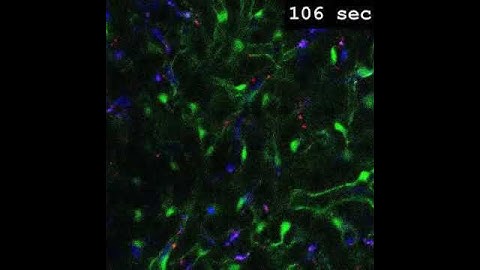 Time-lapse video of 600×200 nm particle uptake by Kupffer cells.