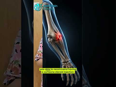 Patient testimonial: elbow pain – Joint Pain Clinics patient video
